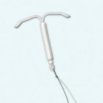 Liletta® is a T-shaped IUD for long acting reversible contraception (LARC).